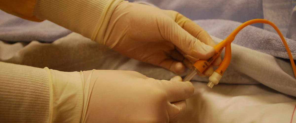 Infermiere che gestisce un catetere vescicale